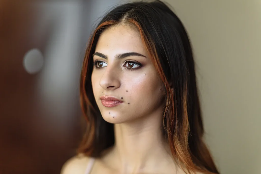 close-up portrait of young model with moles