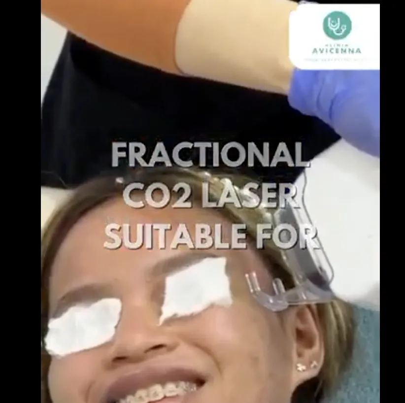 Transformasi Kulit Anda dengan Rawatan CO2 Laser di Klinik Avicenna